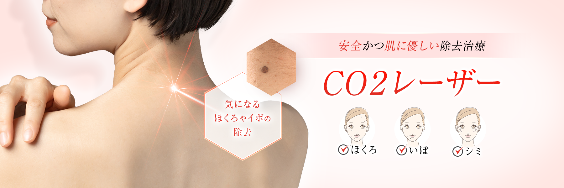 CO2レーザー