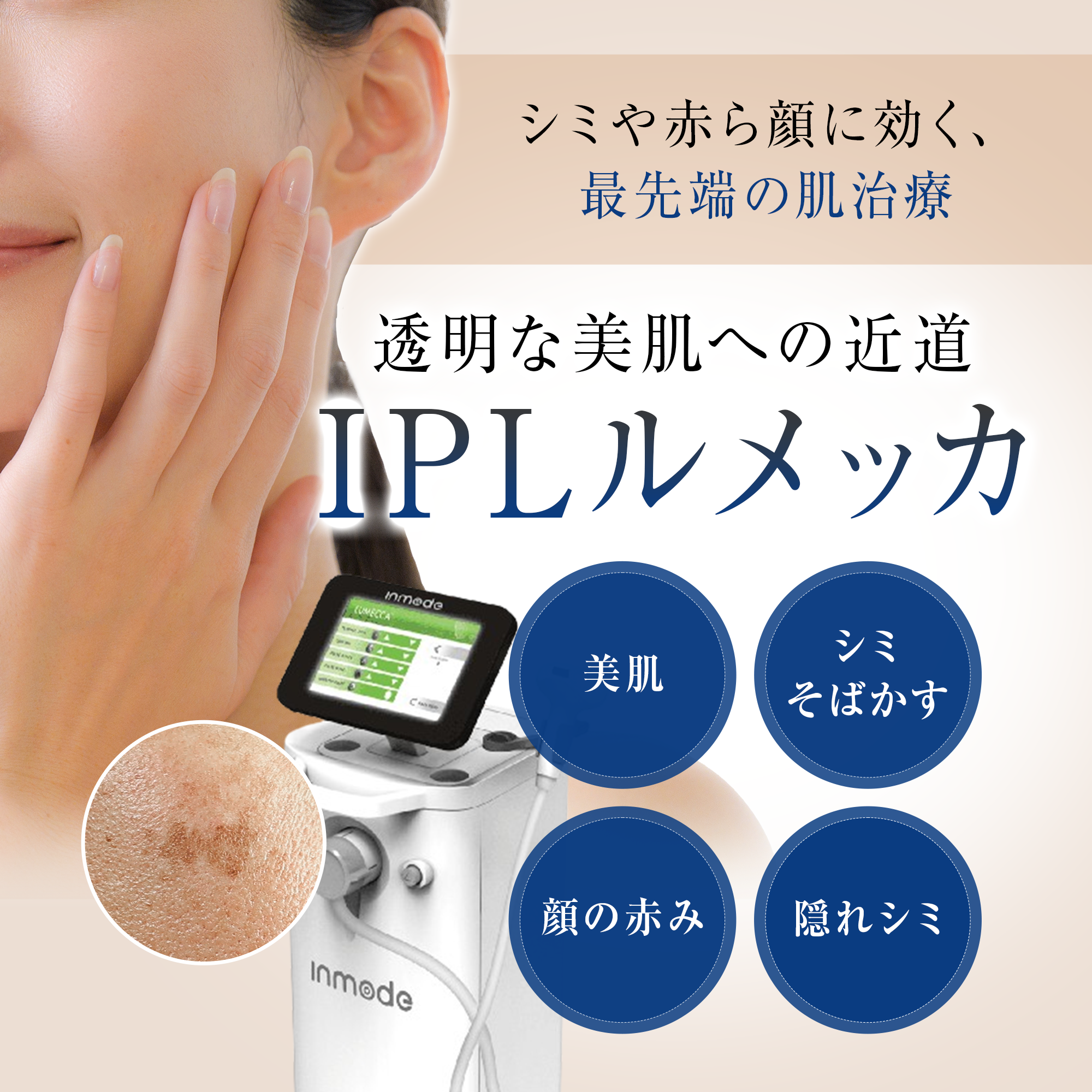 IPLルメッカ