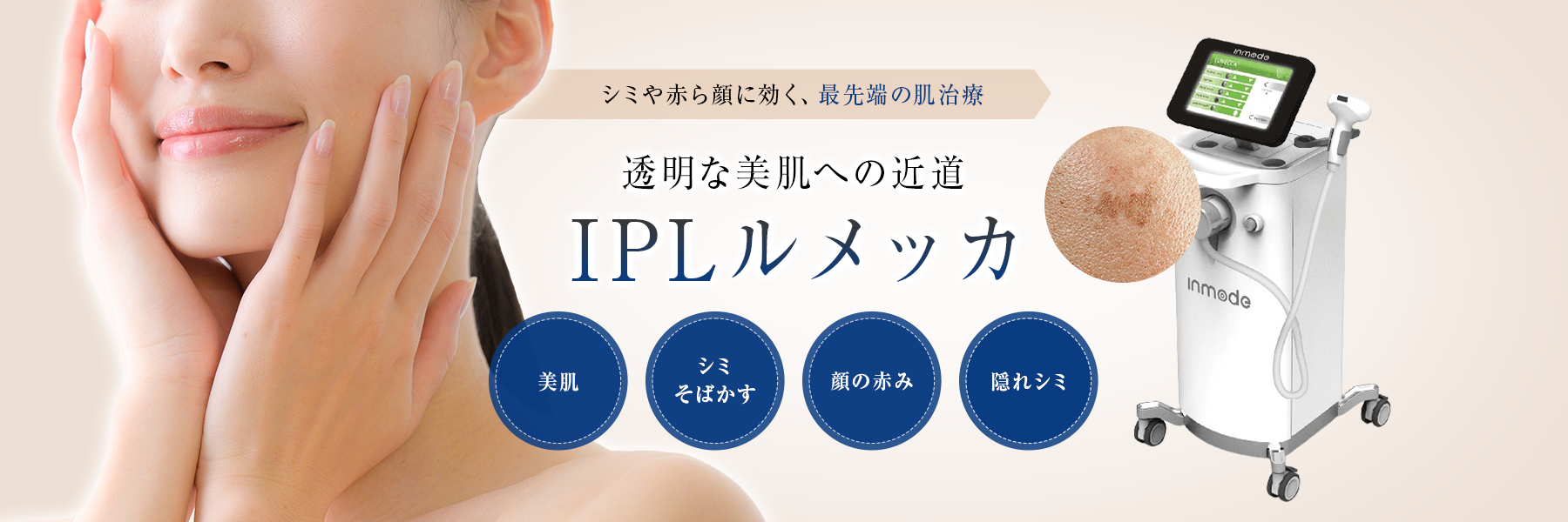 IPLルメッカ